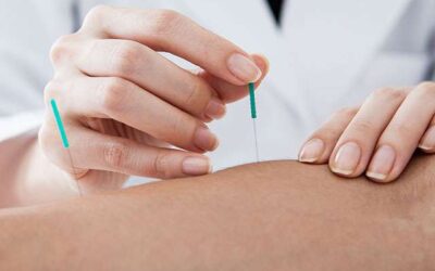 Is Acupuncture Good for You